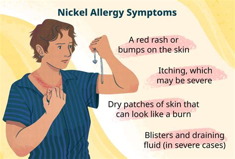 Nickel Allergy Causes Symptoms Treatment Tests And More