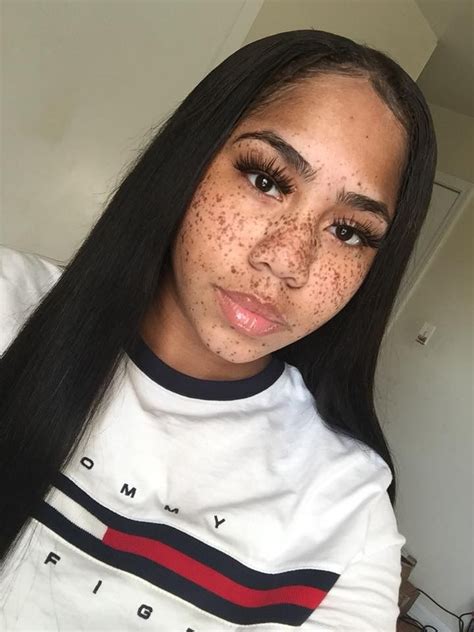 Pin By Kailee On Beauty ♡ Black Girls With Freckles Beautiful