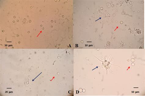 Primer Aislamiento De Acanthamoeba Spp En Agua De Mar Del Sudeste Bonaerense Argentina