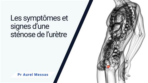 Urètre Chez Lhomme Douleurs And Inflammations Pr Messas