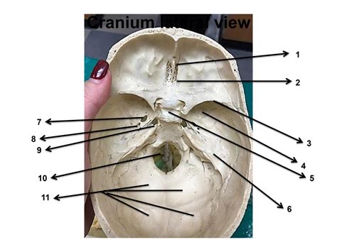 Cranium Superior Interior View Diagram Quizlet