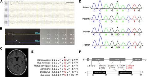 Frontiers Identification And Characterization Of A New Variation In