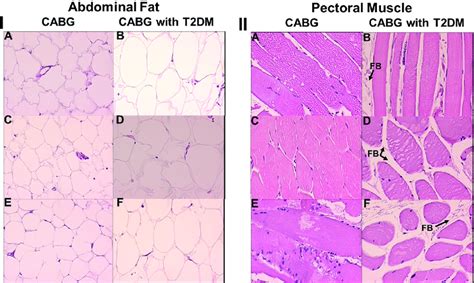 H And E Histology Of Abdominal Fat I And Pectoral Muscle Ii From Download Scientific Diagram