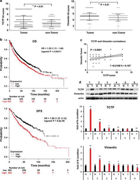 The Expression And Correlation Of Tctp And Vimentin In Human Lung Tumor