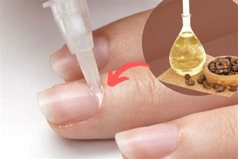 Comment Utiliser L Huile De Ricin Pour Les Ongles Et Les Faire Pousser