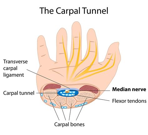 Endoscopic Carpal Tunnel Release