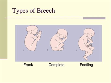 breech  powerpoint    id