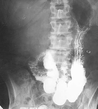 abdomen  gi studies flashcards quizlet