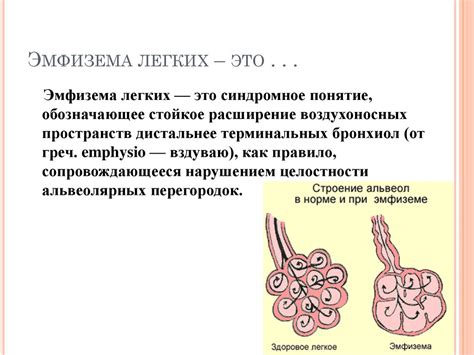 Патоморфология эмфиземы легких - презентация онлайн