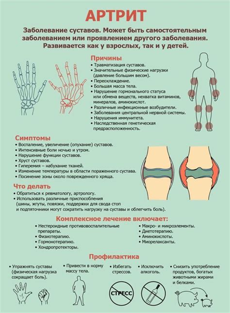 Артрит | Пикабу