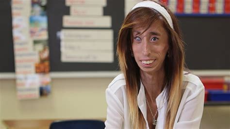 La Historia De Lizzie Velasquez Youtube