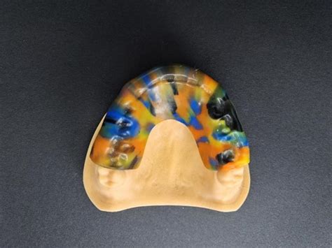 Sport Mouth Guard PRODUCTS Products An Outsourcing Dental Lab