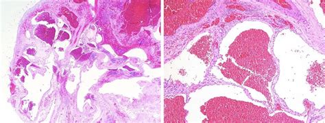 A Low Power Microscopic View Hematoxylin And Eosin Stain 20x