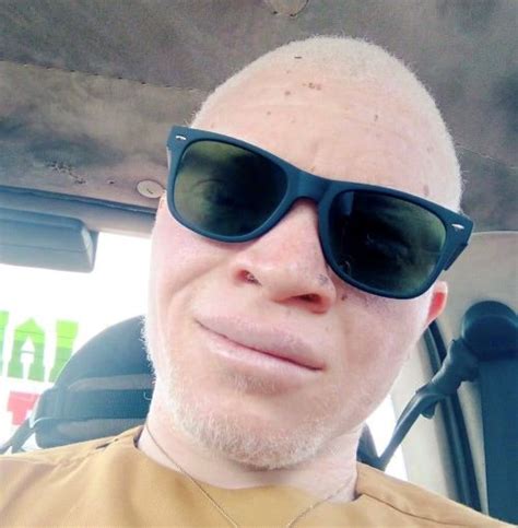 Nigeria Inclusive Education For Persons With Albinism Nigeria