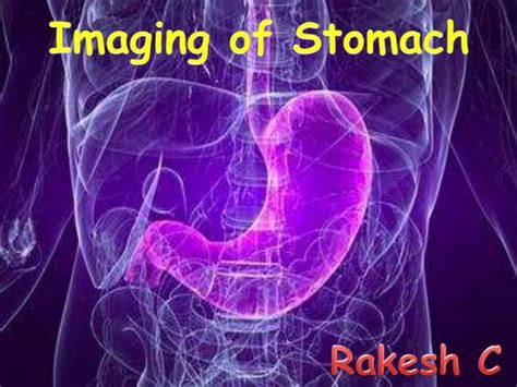 Imaging Of Stomach Ppt