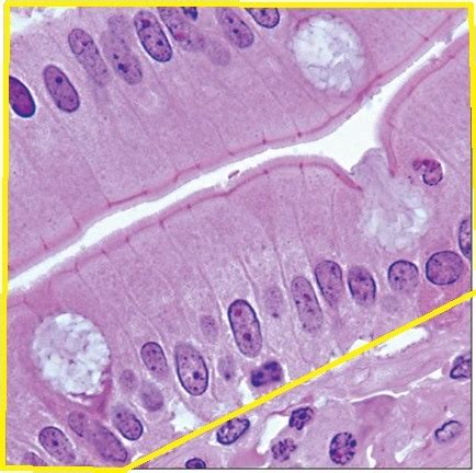 Epithelium Flashcards Quizlet