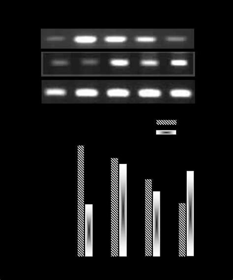 Semi Quantitative RT PCR Analysis Of CPT 1 And FASN MRNA Expressions