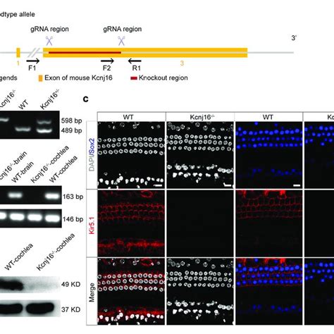 The Expression Of Kcnma Kcnq And Kcne Decreased In P Kcnj