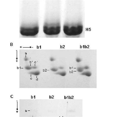 A Schematic Pattern Of Electrophoretic Mobility Of The Main Peptides