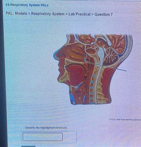 Solved Respiratory System Lab Practical Question 7 Chegg