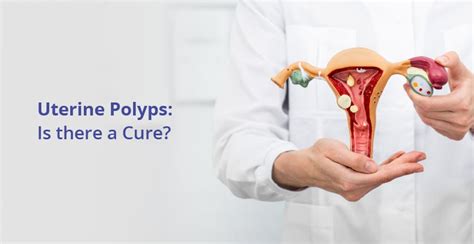 What Is Uterine Polyps Causes Treatment Birla Fertility IVF