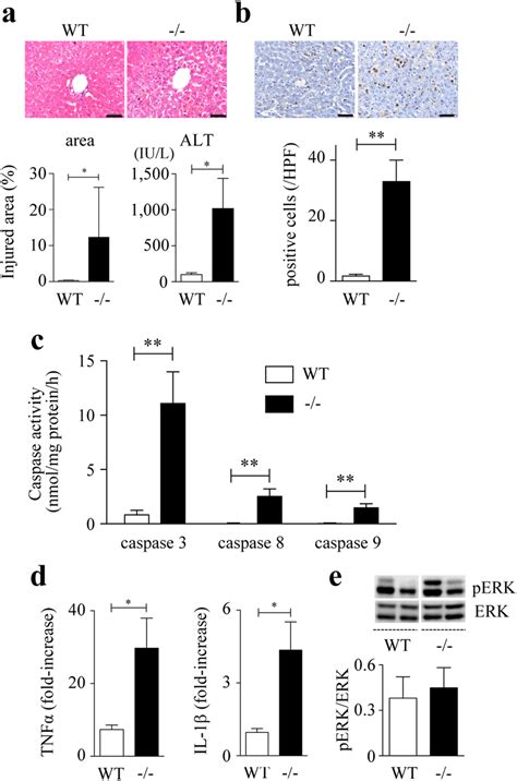 D Galntnfα Induced Liver Injury Wt And Spred2 −− Mice Were Injected