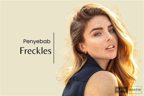 Penyebab Freckles Di Wajah Yang Kerap Kali Terjadi