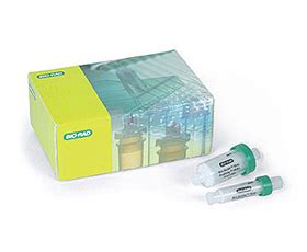 His-Tag Purification | Chromatography Media, Columns & Kits | Bio-Rad