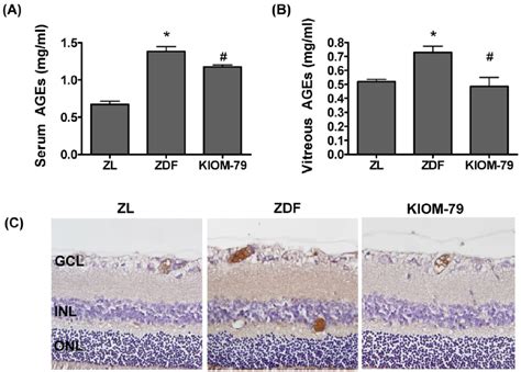 Effect Of KIOM 79 On The Formation Of Advanced Glycation End Products