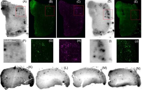 In Vitro Autoradiography Of 18 F Radiolabeled Ligands R 18 F 5 A