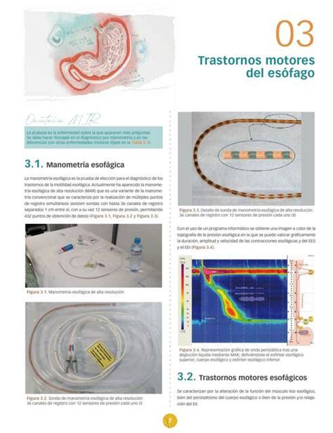 Trastornos Motores Del Es Fago Full Ciencia Udocz