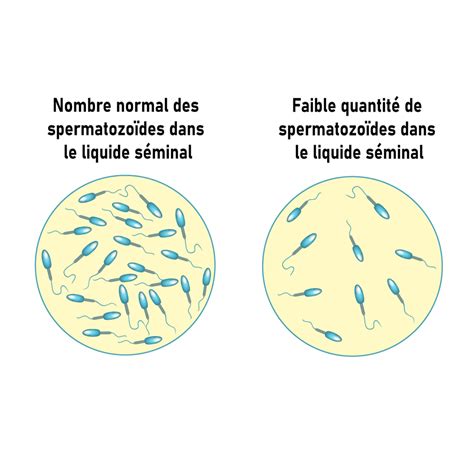 Spermogramme D Roulement Et Pr Cautions Prendre