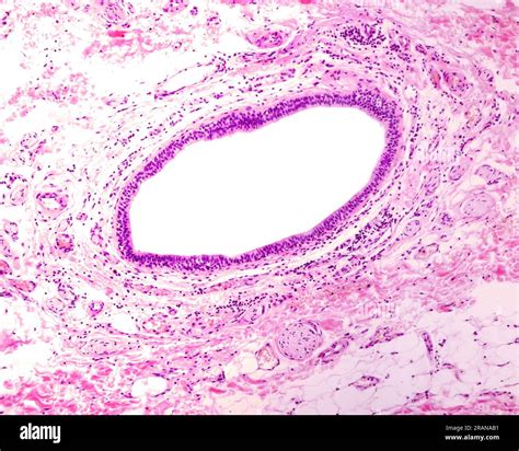 Human Parotid Gland Excretory Duct Light Micrograph Stock Photo Alamy