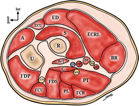 Schematic Drawing Of A Crosssection Of An Elbow Demonstrating The