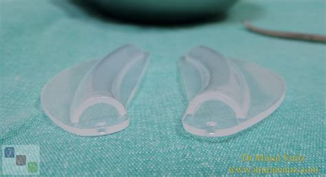 Rhinoplasty Recovery Guide 👃 - 42 - Will Nasal Packing Be Needed After Rhinoplasty Operation?