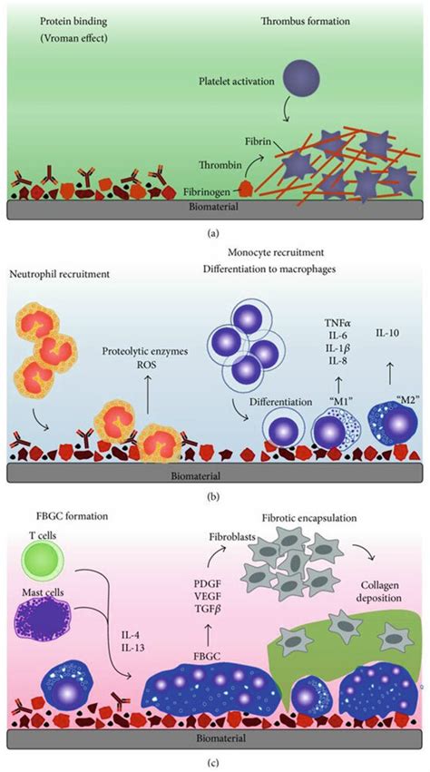 3 Foreign Body Response After Introducing Biomaterials Into The Body Download Scientific