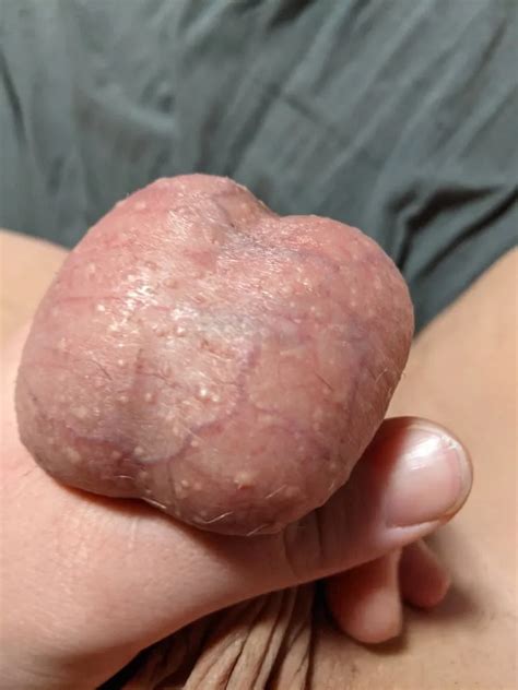 Ball Pictures 2 Hurting Balls Need A Relief 19 Nude Pics XHamster