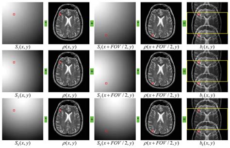 Sensors Free Full Text A Support Based Reconstruction For Sense Mri