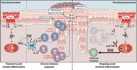 Frontiers Psoriasis Classical Vs Paradoxical The Yin Yang Of Tnf And Type I Interferon