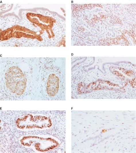 Immunohistochemistry For Survivin P53 BCL 2 Ki 67 And Apoptosis