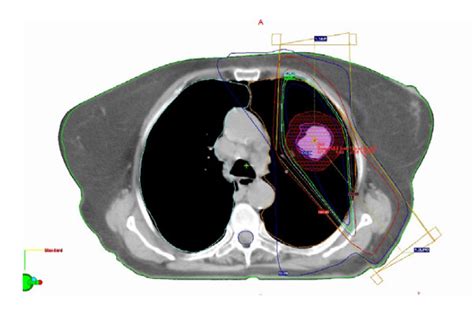 Example Of Typical 3 Dimensional Planning With 2 Fields Avoiding The Download Scientific