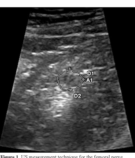 Figure From Ultrasound And Magnetic Resonance Imaging Evaluation Of