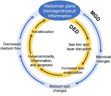 Importance of MGD in DED pathology. DED dry eye disease, MGD meibomian ...