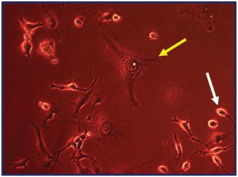 Mda Mb 231 Cells—initiating Morphology Consistent With Rounded White