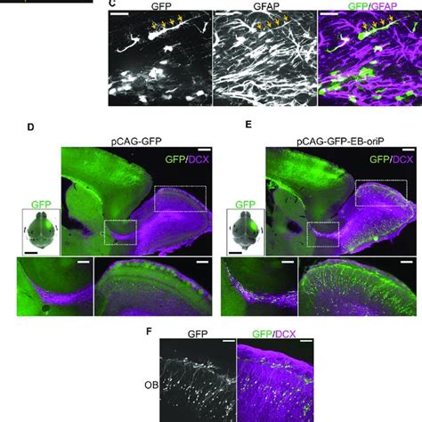 Transgene Expression In Radial Glial Cells By Iue Of The Eb Orip