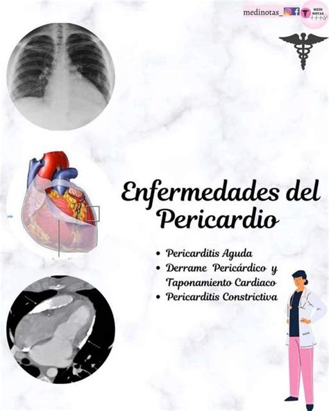 Enfermedades Del Pericardio YUDOC ORG UDocz