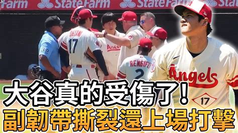 【mlb 美國職棒】大谷翔平真的受傷了 副韌帶撕裂還上場打擊 本季投手提前關機 Youtube