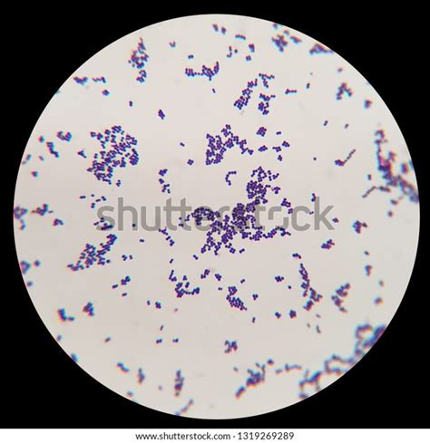 Strep Throat Bacteria Under Microscope