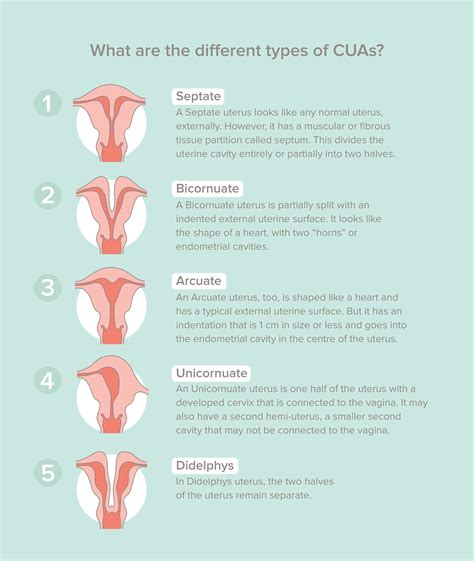 Symptoms Of Congenital Uterine Anomalies Guide To Cua In Sync Blog