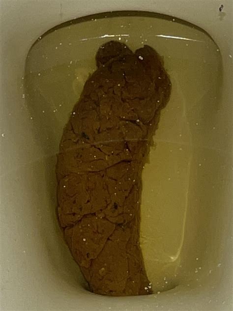 Worried ~ My stool has blood in it and or black spots : r/poop